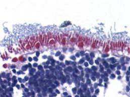 AIF Antibody in Immunohistochemistry (Paraffin) (IHC (P))