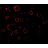 MADD Antibody in Immunocytochemistry (ICC/IF)