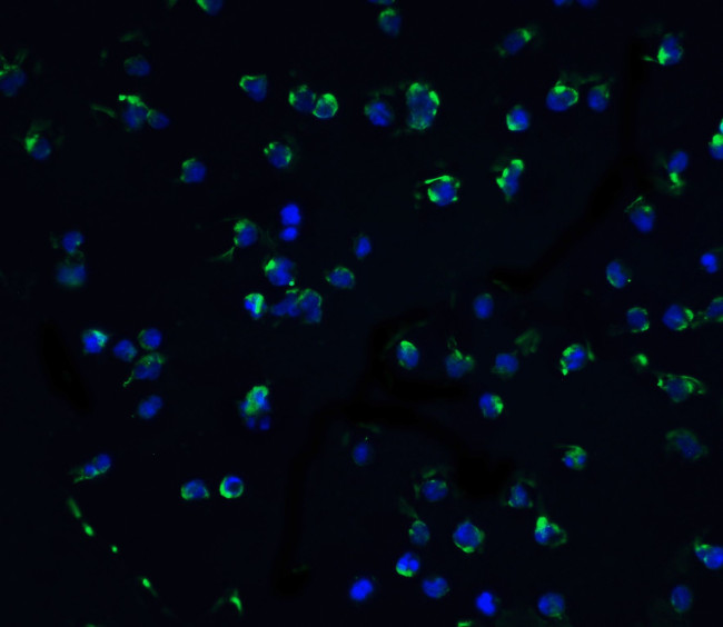 ZIPK Antibody in Immunocytochemistry (ICC/IF)