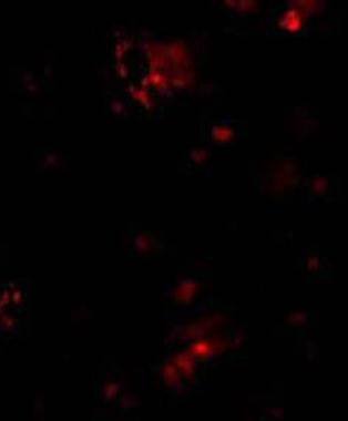 CD263 (TRAIL-R3) Antibody in Immunocytochemistry (ICC/IF)