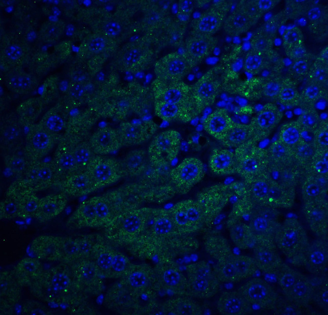 F1A alpha Antibody in Immunohistochemistry (Paraffin) (IHC (P))