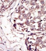 RYK Antibody in Immunohistochemistry (Paraffin) (IHC (P))