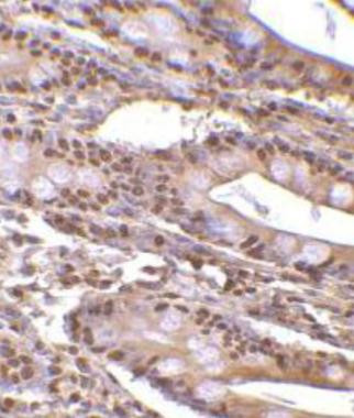 PHAP III Antibody in Immunohistochemistry (Paraffin) (IHC (P))