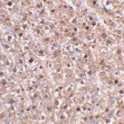 Caspase 12 Antibody in Immunohistochemistry (Paraffin) (IHC (P))