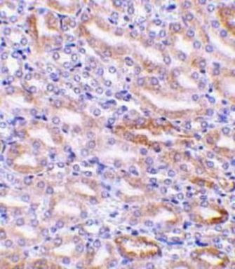 DFFB Antibody in Immunohistochemistry (IHC)