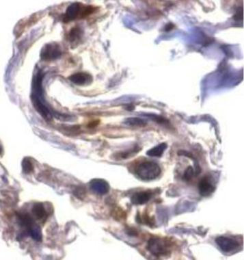 ARTS Antibody in Immunohistochemistry (Paraffin) (IHC (P))