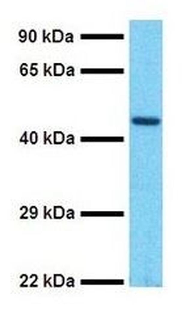 SOX5 Antibody in Western Blot (WB)