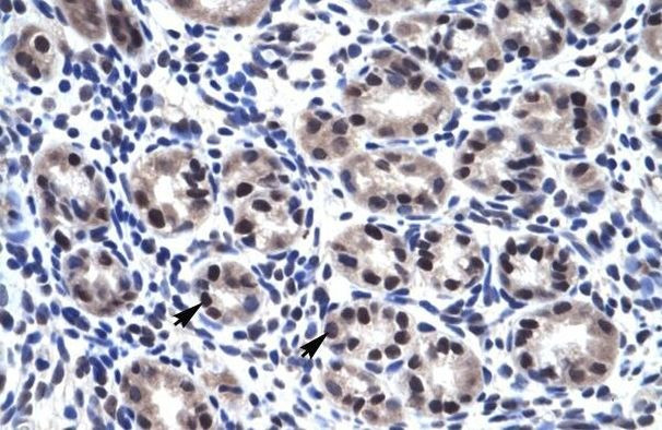 SP7 Antibody in Immunohistochemistry (Paraffin) (IHC (P))