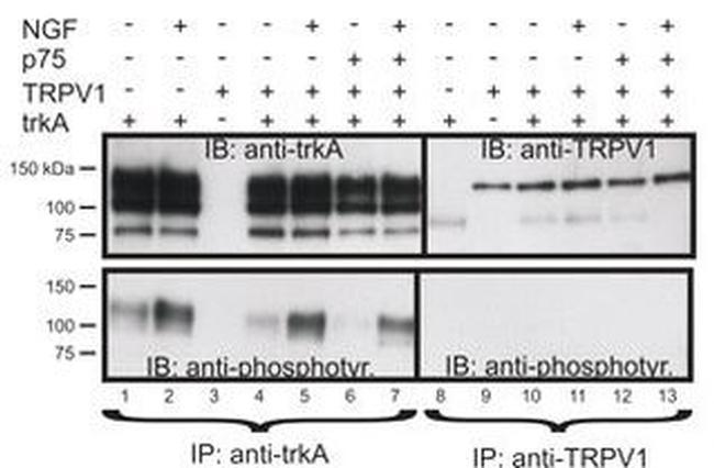 TRPV1 Antibody in Western Blot (WB)