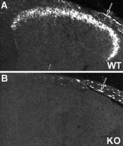 NPY Antibody in Immunohistochemistry (IHC)