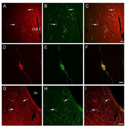 Orphanin FQ Antibody in Immunocytochemistry (ICC/IF)