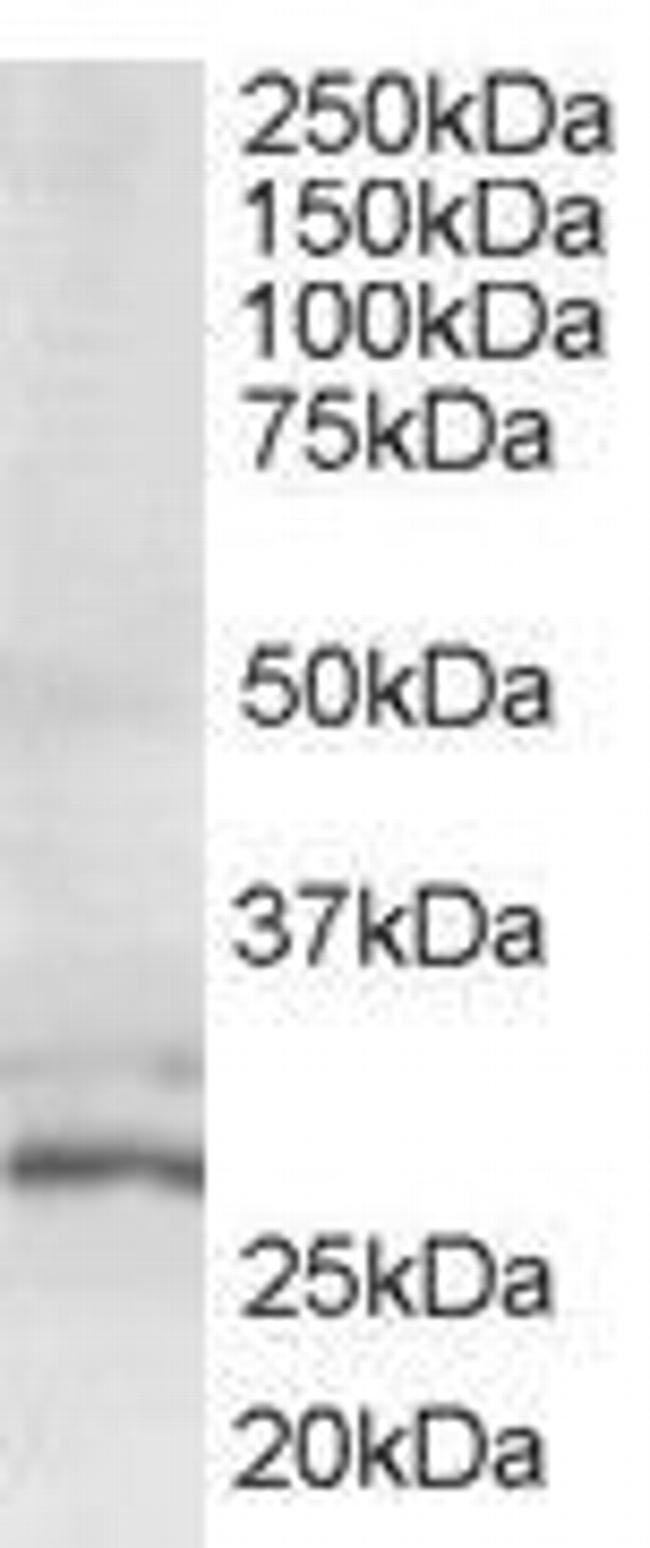 TIP30 Antibody in Western Blot (WB)