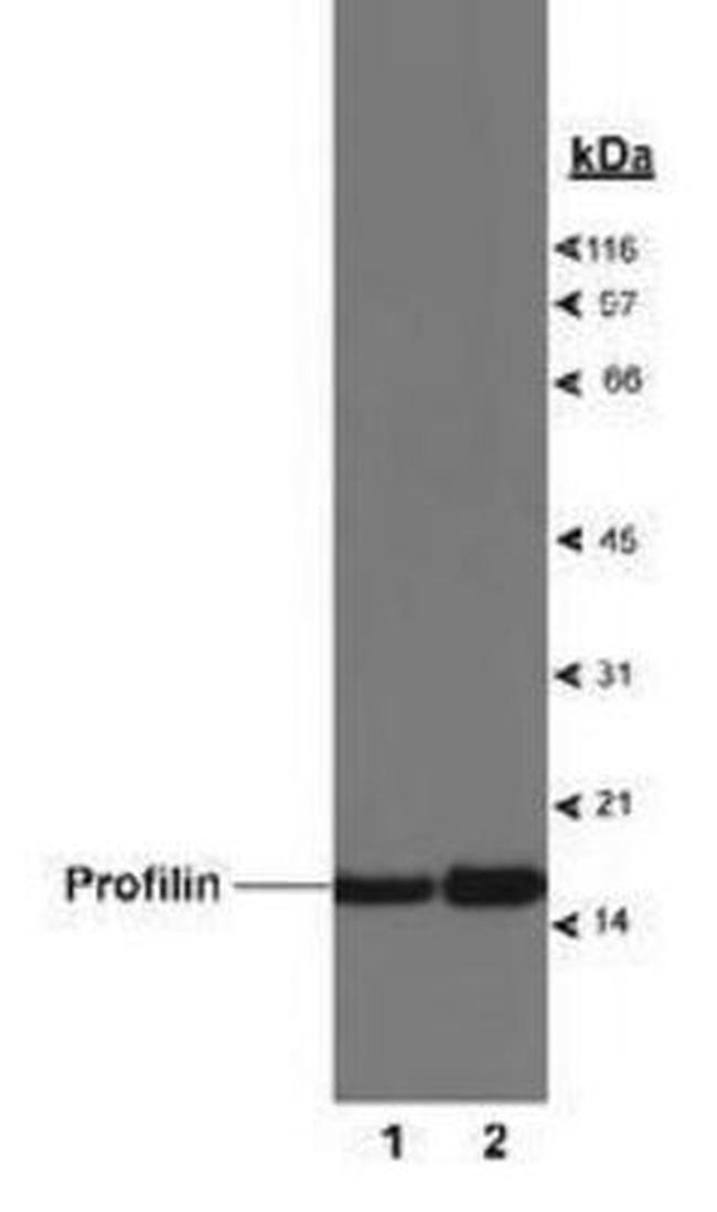 Profilin 1 Antibody in Western Blot (WB)