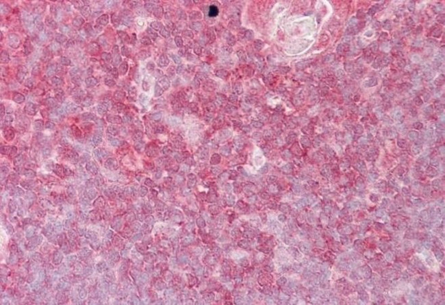 ELF1 Antibody in Immunohistochemistry (Paraffin) (IHC (P))