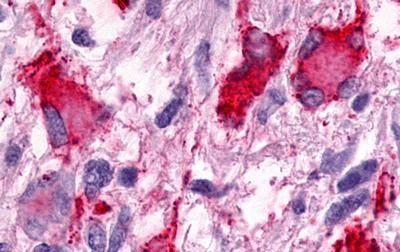 GPR25 Antibody in Immunohistochemistry (Paraffin) (IHC (P))