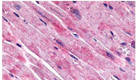 FZD7 Antibody in Immunohistochemistry (Paraffin) (IHC (P))