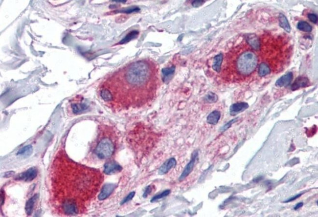 JWA Antibody in Immunohistochemistry (Paraffin) (IHC (P))