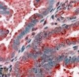 ACTR1B Antibody in Immunohistochemistry (Paraffin) (IHC (P))