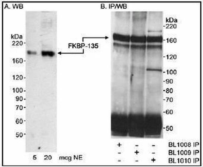 FKBP15 Antibody in Western Blot (WB)