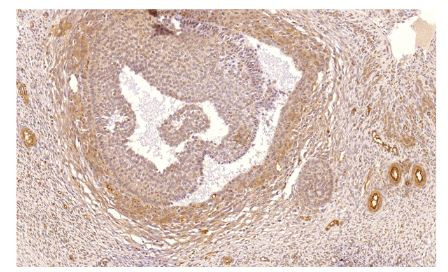 PDE1C Antibody in Immunohistochemistry (IHC)
