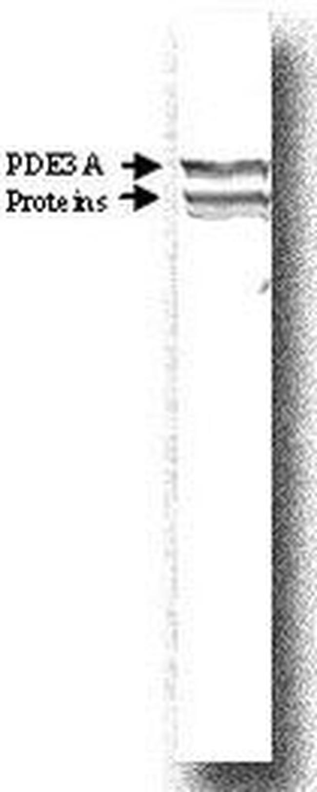 PDE3A Antibody in Western Blot (WB)