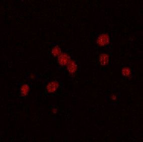 PDE2A Antibody in Immunocytochemistry (ICC/IF)