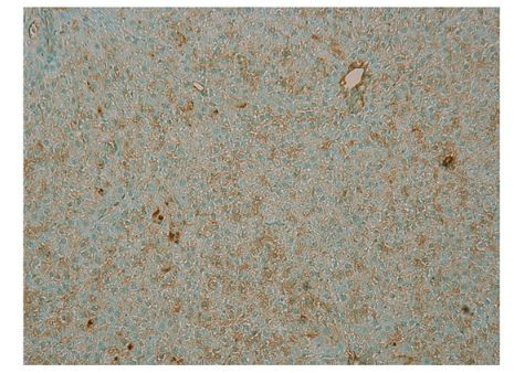 PDE4B Antibody in Immunocytochemistry (ICC/IF)