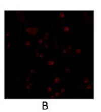 PDE4B Antibody in Immunocytochemistry (ICC/IF)