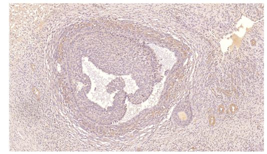 PDE7A Antibody in Immunohistochemistry (IHC)
