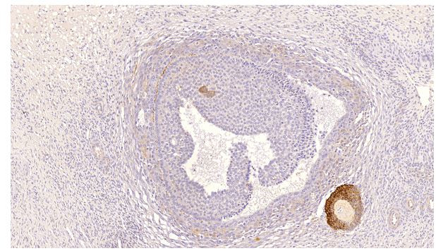 PDE8B Antibody in Immunohistochemistry (IHC)