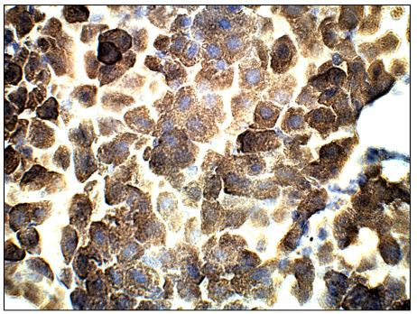 Adenylate Cyclase 3 Antibody in Immunohistochemistry (Paraffin) (IHC (P))