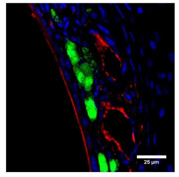 Brevican Antibody in Immunohistochemistry (IHC)