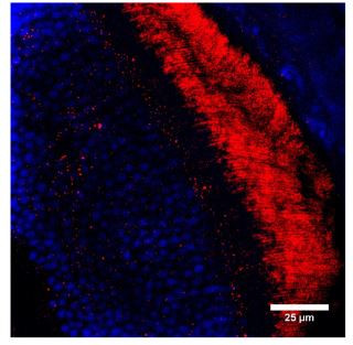 PGCF Antibody in Immunohistochemistry (IHC)