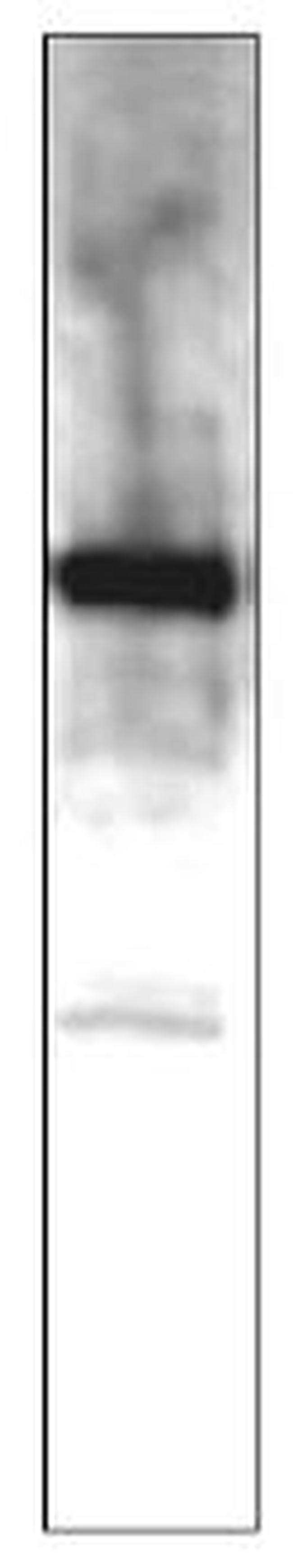 MERTK Antibody in Western Blot (WB)