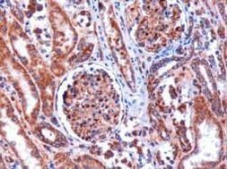 Kinesin 5B Antibody in Immunohistochemistry (Paraffin) (IHC (P))