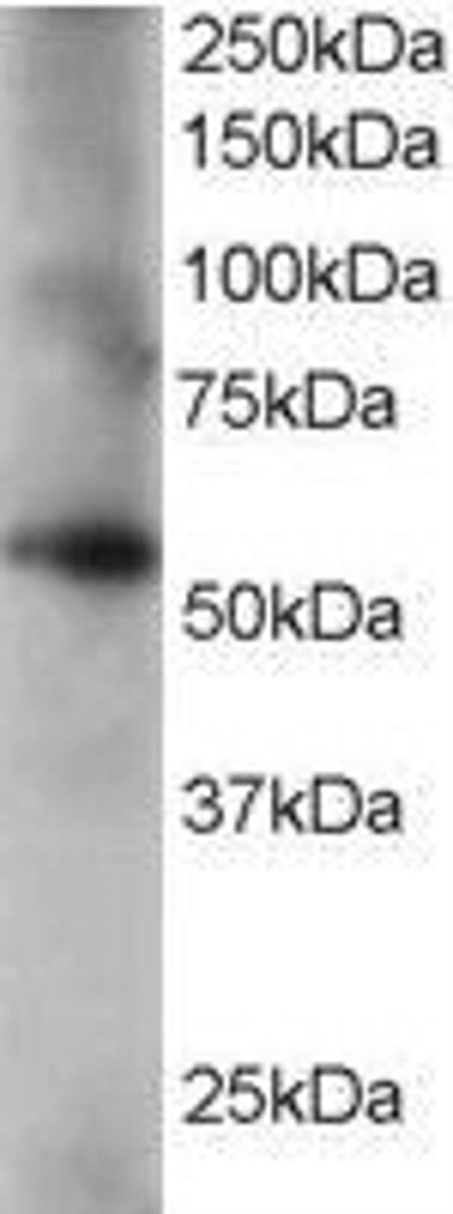 Coronin 3 Antibody in Western Blot (WB)