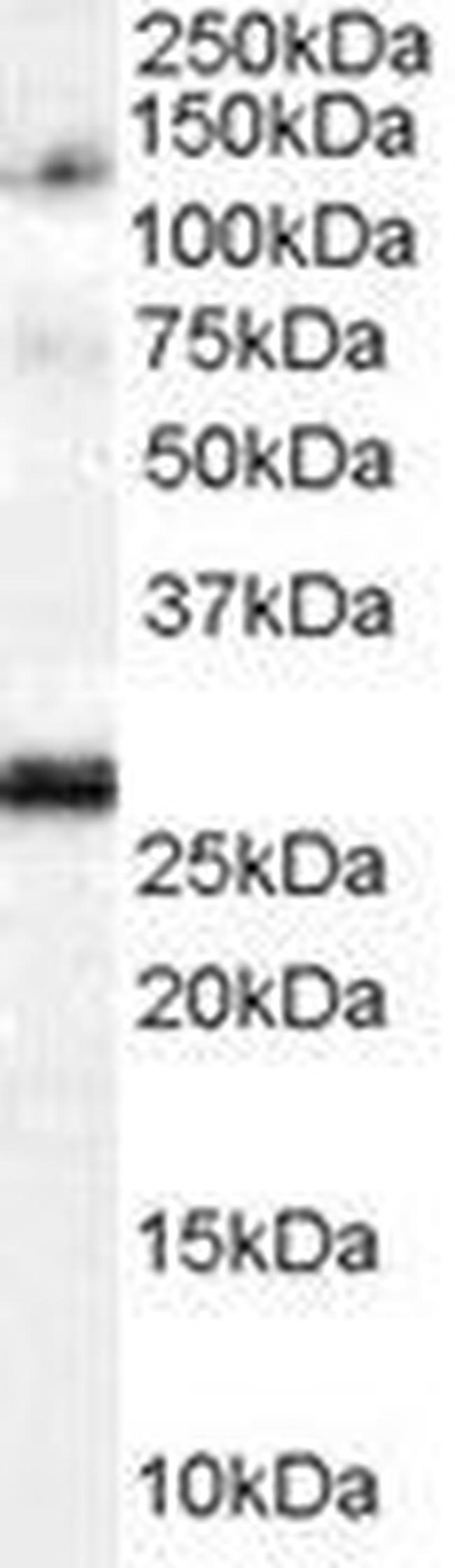 Importin 7 Antibody in Western Blot (WB)