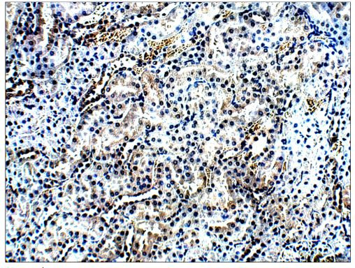 AMACR Antibody in Immunohistochemistry (Paraffin) (IHC (P))