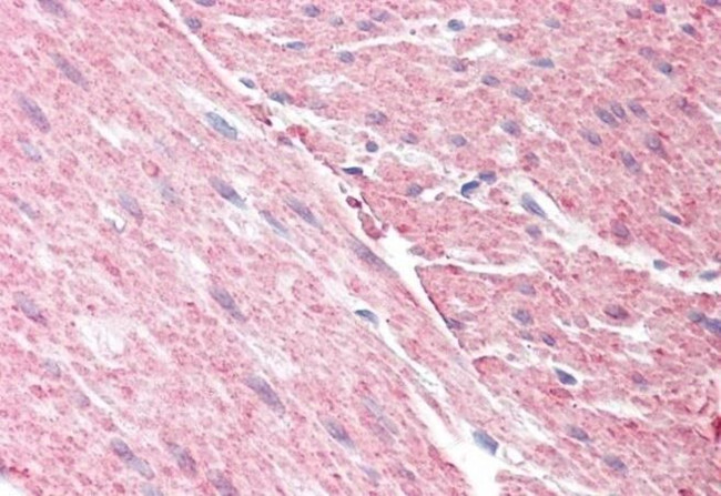 GRAF Antibody in Immunohistochemistry (Paraffin) (IHC (P))