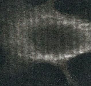 Calreticulin Antibody in Immunocytochemistry (ICC/IF)