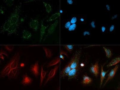 Beclin 1 Antibody in Immunocytochemistry (ICC/IF)