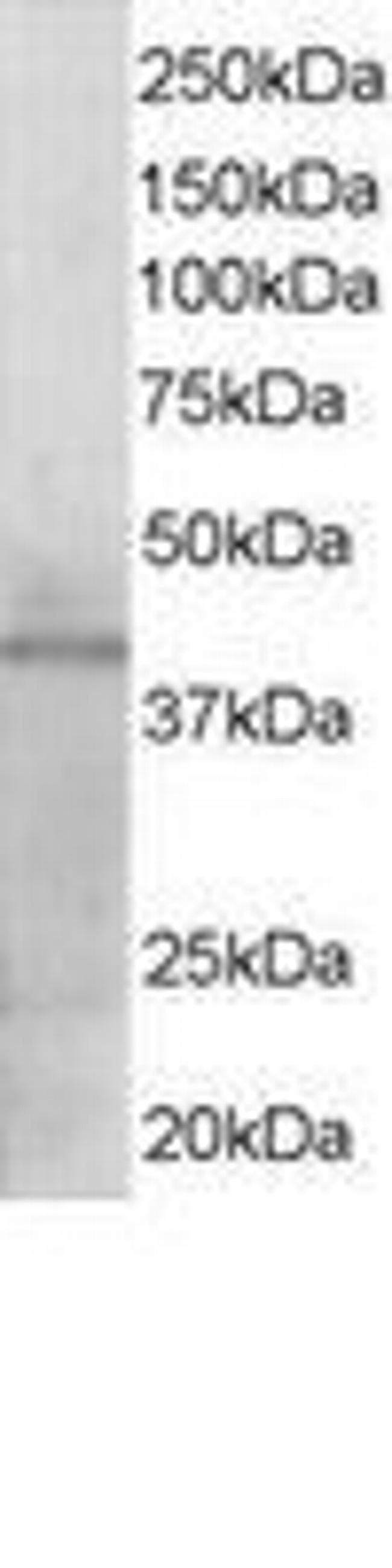 KLF3 Antibody in Western Blot (WB)