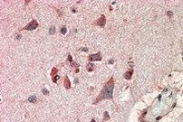 FBXL2 Antibody in Immunohistochemistry (Paraffin) (IHC (P))