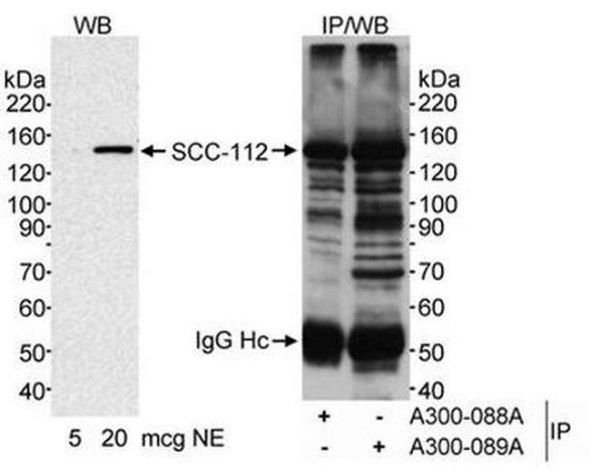 PDS5A Antibody in Western Blot (WB)