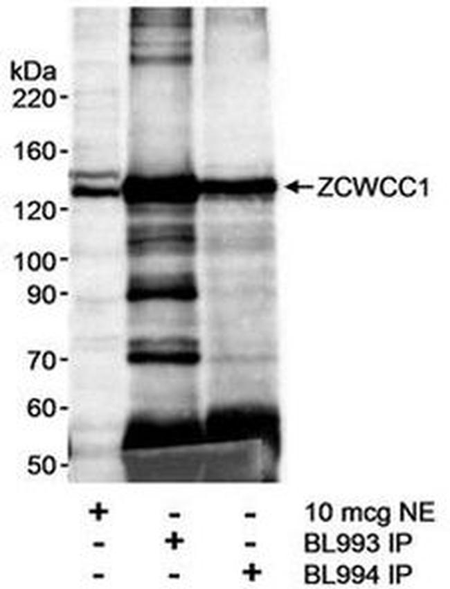 ZCWCC1 Antibody in Western Blot (WB)