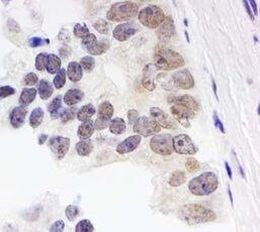 EMSY Antibody in Immunohistochemistry (Paraffin) (IHC (P))