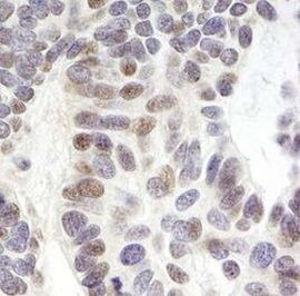 ZNF261 Antibody in Immunohistochemistry (Paraffin) (IHC (P))