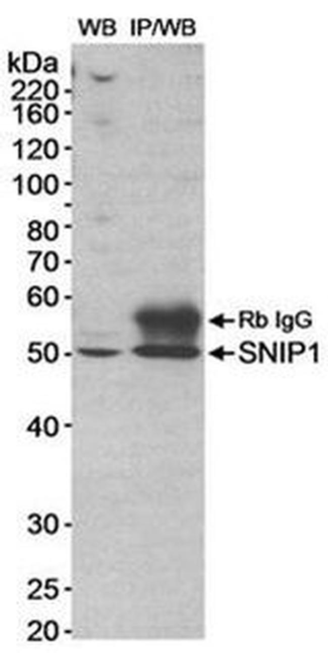 SNIP1 Antibody in Western Blot (WB)