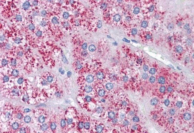 MTA1 Antibody in Immunohistochemistry (Paraffin) (IHC (P))
