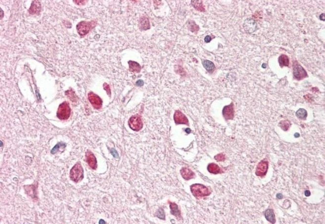 BAI1 Isoform 3 Antibody in Immunohistochemistry (Paraffin) (IHC (P))